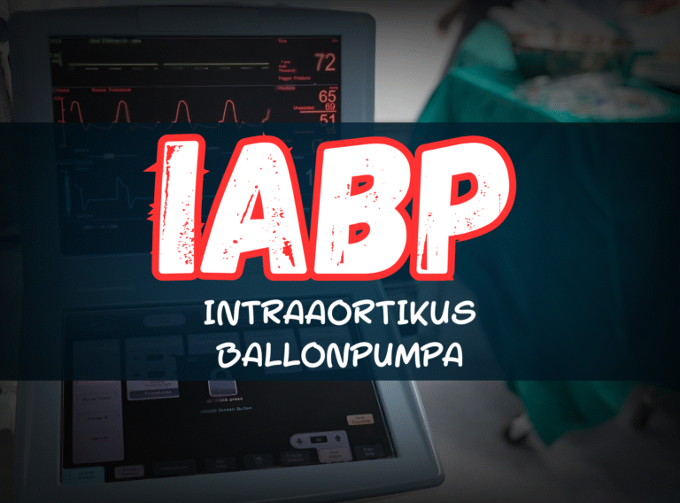 Mi az az intraaortikus ballonpumpa (IABP)?